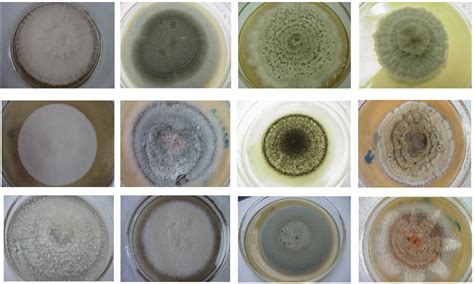 Figure From Diversity Of Culturable Endophytic Fungi Vary Through