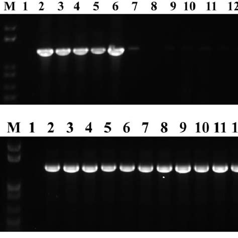 Agarose Gel Electrophoresis Of Partial 16s Rrna Gene Pcr Products