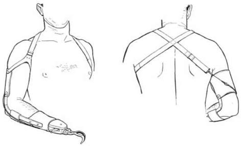 Fig 9 Prosthesis And Harness For Wrist Disa Oandp Digital Resource