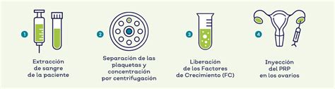 Rejuvenecimiento Ovárico Con Prp En Qué Consiste Ivf Life