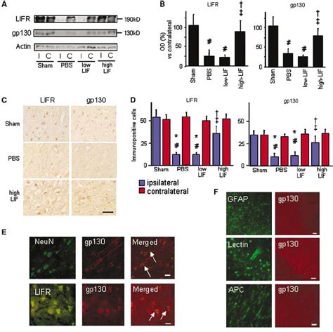 A Western Blot Analyses Of Leukemia Inhibitory Factor Receptor