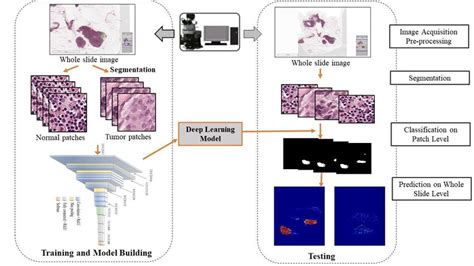 The Workflow Of Deep Learning Driven Diagnostic System For Metastatic