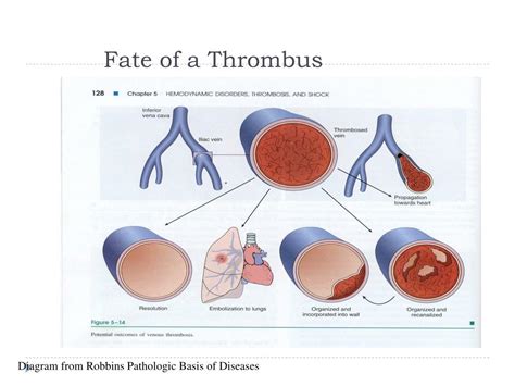 Ppt Thrombophilia Powerpoint Presentation Free Download Id 4621651