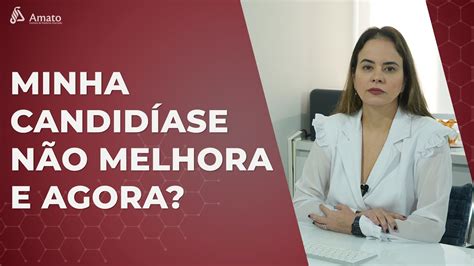 Tudo O Que Voc Precisa Saber Para Melhorar A Sua Candid Ase Youtube