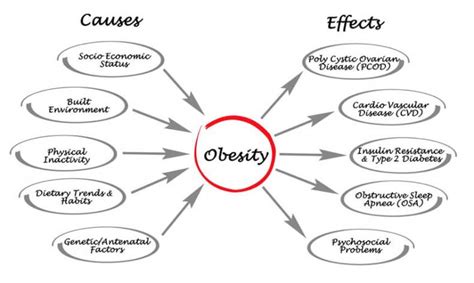 Causes And Treatment Of Obesity - Health Blog