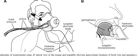 PDF A Comprehensive Assessment Of Genioglossus Electromyographic