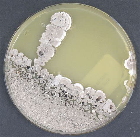 Streptomyces Lydicus Type Strain Dsm Atcc Cbs