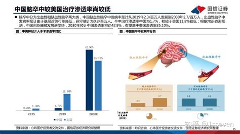 创新医疗器械——神经介入：技术创新与进口替代！ 知乎