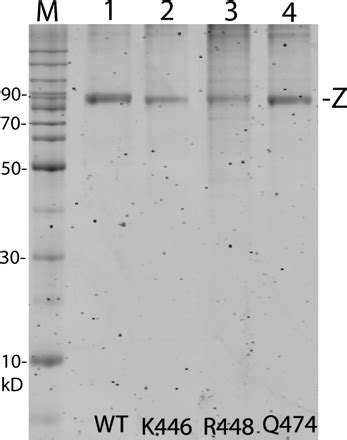 Residues In Two Homology Blocks On The Amino Side Of The TRNase Z His