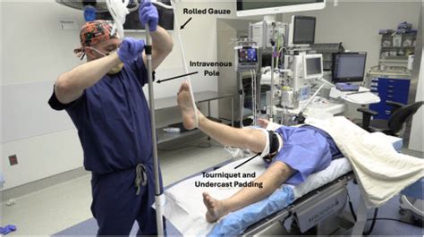 Basics Of Ankle Arthroscopy Part 1 Patient Positioning And Preparation