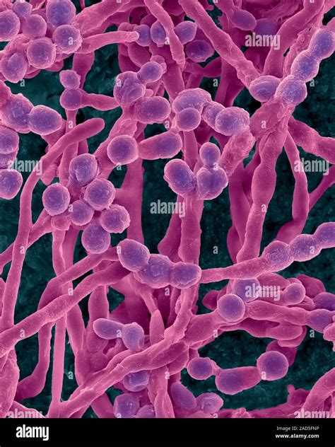 Coloured Scanning Electron Micrograph Sem Of The Common Environmental