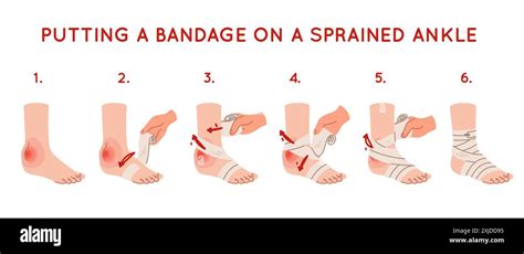 Applying Elastic Bandage To Ankle Foot Injury Soft Tissues Swelling