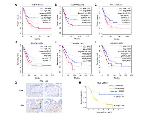 ECM Associated Genes Are Highly Expressed In CSFs And Associated With