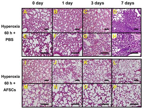 Histological Comparisons Of Lung Tissues From The Hyperoxia Exposed