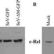 Nuclear Localization Pattern Of Relb And C Rel Proteins In Sev Infected