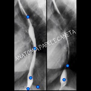 Jogos De Anatomia Humana Abdome Anatomia Papel E Caneta