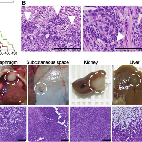 P21 Loss Confers Metastatic Capacity To Lung Adenocarcinomas In K Ras Download Scientific