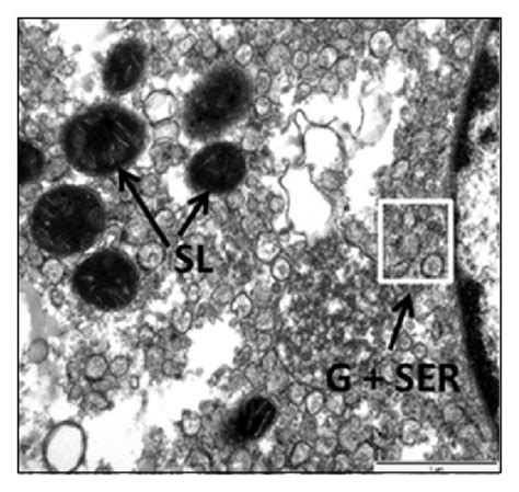 Histology And Electron Microscopy A Normal Liver Lobule With Pale