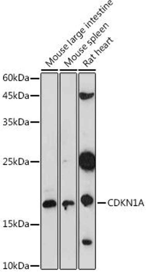 Anti Cdkn1a 抗体 Assay Genie