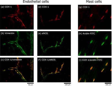 Figure 1 From Localization Of COX 1 And COX 2 In The Intracranial Dura