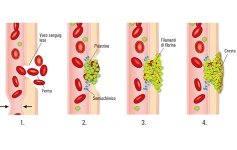 Emostasi Cos Sintomi Trombosi E Anticoagulanti