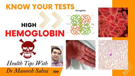 What is High Hemoglobin and its causes - YouTube