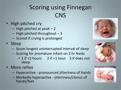 PPT Neonatal Abstinence Syndrome NAS PowerPoint Presentation Free