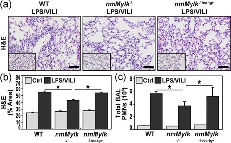 Endothelialspecific Overexpression Of Nmmlck Abolishes The Protection