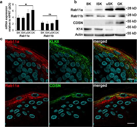 Rab A Is Essential For Lamellar Body Biogenesis In The Human Epidermis