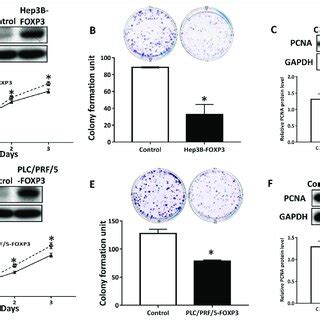 The expression of FOXP3 and FOXP3Δ3 in HCC tissue samples a The