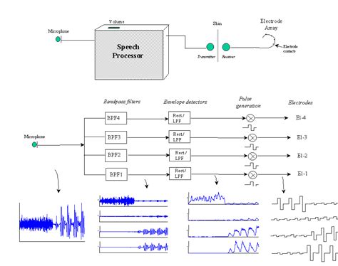 Introduction To Cochlear Implants