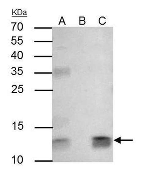 Beta 2 Microglobulin Antibody Pa5 29580