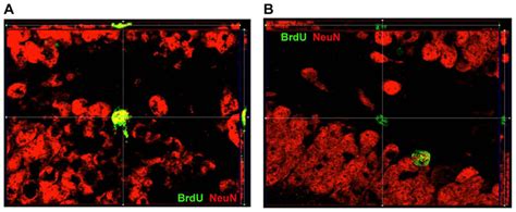 Apotome Image Of Localization Of Brdu And Neun Within Dg A