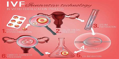 Ivf Procedure Step By Step Ivf Process Start To Finish