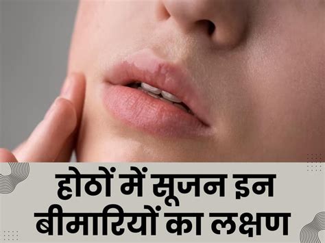 लिप्स की सूजन हो सकती है इन गम्भीर बीमारियों का संकेत बिना देर किए डॉक्टर से करें सम्पर्क