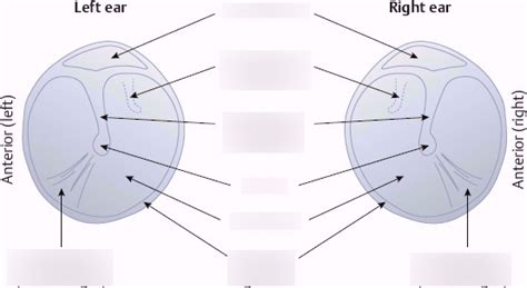 Tympanic Membrane Diagram