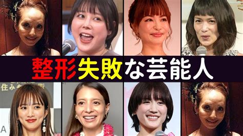 整形失敗で見た目が豹変した芸能人7選 Youtube