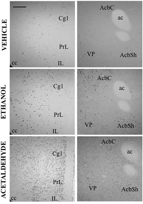 C Fos Induction After IP Administration Of Saline Ethanol 0 5 G Kg