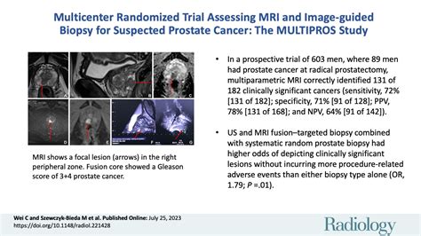 Multicenter Randomized Trial Assessing Mri And Image Guided Biopsy For