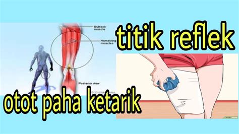 Titik Refleksi Menyembuhkan Otot Paha Ketarik Dan Terasa Linu PIJAT