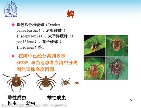 烟台市政府门户网站 健康科普 常见传染病预防