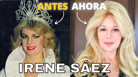 IRENE SÁEZ ANTES Y AHORA QUÉ ESTÁ HACIENDO EN LA ACTUALIDAD