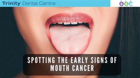 Mouth Cancer Early Stages