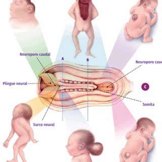 PDF SALUD BRASIL 2020 2021 ANOMALÍAS CONGÉNITAS PRIORITARIAS PARA LA