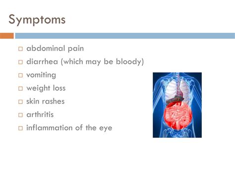 Ppt Crohn’s Disease Powerpoint Presentation Free Download Id 1834272