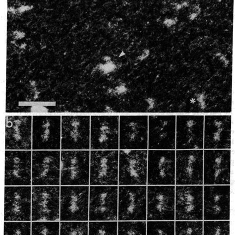 Dark Field Electron Micrographs Of Unstained SRP A Overview