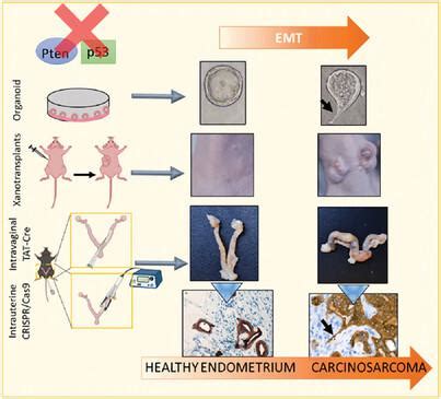 TAT 融合 Cre 重组酶和 CRISPR Cas9 编辑系统在小鼠体内的子宫内递送揭示了 Pten p53 缺陷型子宫内膜癌的组织病理学