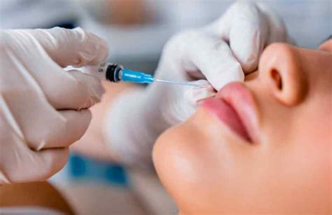 Botox Pour Corriger Le Sourire Gingival Technique Et R Sultats Le