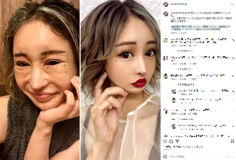 「ノーマルカメラで撮った自分がブス過ぎて」整形へ キャバ嬢youtuberが 報告 「アプリに騙されるな」 J Cast ニュース