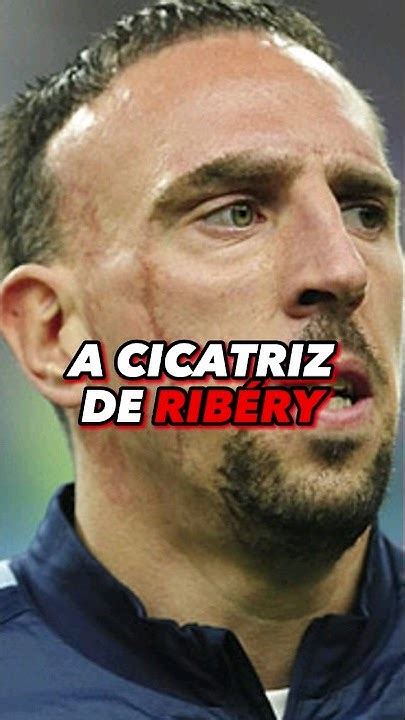 A Triste História Da Cicatriz De Ribéry Shorts Futebol Ribéry Youtube